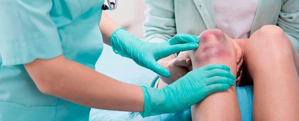 arts onderzoekt knie in geval van blessure