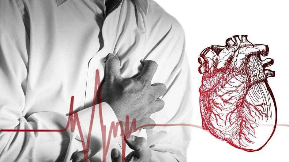 Door een verstoord hartritme bij thoracale osteochondrose kan extrasystole ontstaan