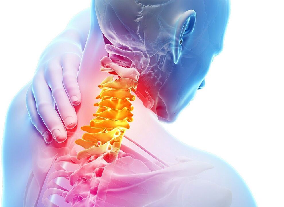 symptomen van spinale osteochondrose