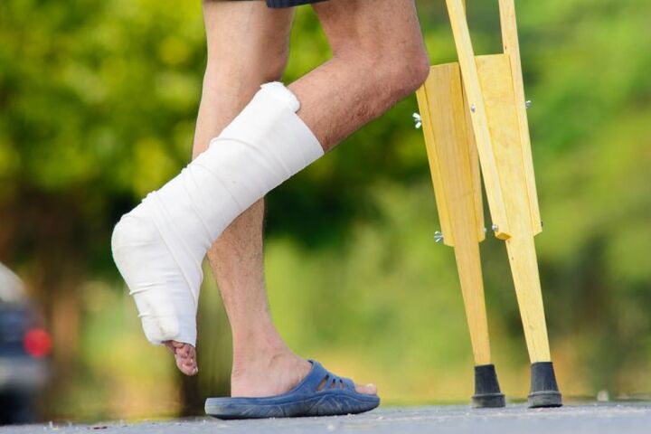 enkelblessure als oorzaak van artrose