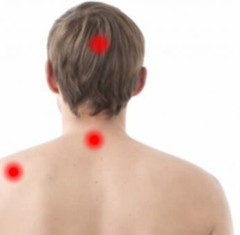 brandpunten van osteochondrose