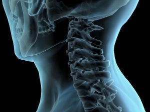 methoden voor het diagnosticeren van osteochondrose van de nek
